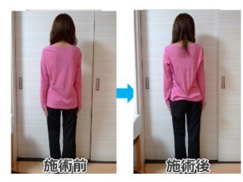 銀座スッキリ整体サロン/整体＋姿勢矯正で背中美人に！