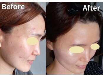 サロン デ ミロ(Salon de Miro)/BeforeAfter多数！ブログへGO♪