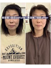 ハリサロンドオフ 堺東店(hari salon de off)/お客様before→after