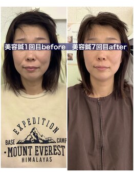 ハリサロンドオフ 堺東店(hari salon de off)/お客様before→after