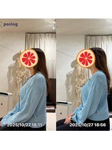 グレフル鍼灸接骨院 整体院 心斎橋/整体/肩こり/マッサージ/腰痛