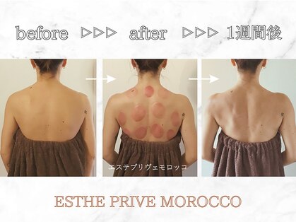 エステプリヴェモロッコ(ESTHE PRIVE MOROCCO)の写真