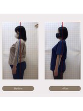 かがわ接骨院 高松伏石院/-30kg減量