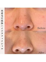 プラウド(Proud)/毛穴洗浄ケア