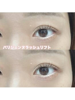 レディエント(Radiant)/パリジェンヌラッシュリフト