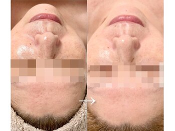 エステドブルー(Este de Bleu)/ビフォーアフター