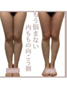 ソワン 小岩店(Soin)/ 20代 下半身