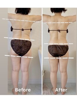 ビジュー(bijou)の写真/服選びが楽しくなる！美ライン痩身リンパで理想のボディへ