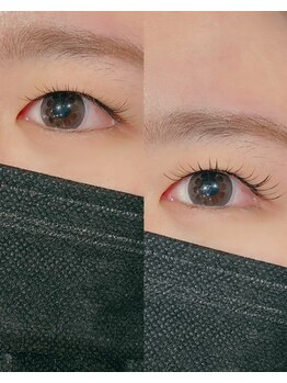 トゥイーディア(Tweedia)/＆Healthy/before.after