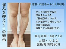 アンジェリーナ/メンズフラッシュ脱毛/都度払い