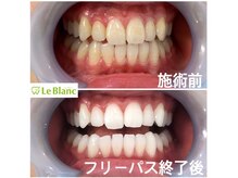 ルブラン 奈良店(Le Blanc)/大事なメンテナンス！