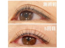 東予初！マイラミネーション正規店痩せないまつ毛、太るまつ毛