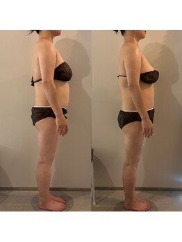 ラナ 京都西院店(Lana)/よもぎ蒸し＆リンパマッサージ