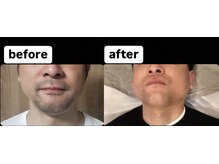 ゴッド(GOD)/ビフォーアフター