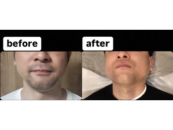 ゴッド(GOD)/ビフォーアフター