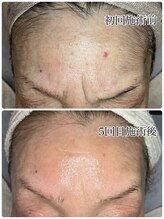 アイリス/シワも目立ちにくく