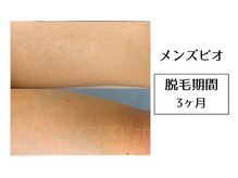 メンズビオ 神戸三宮店/