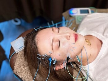 鍼灸院 満月の写真/【小顔矯正￥6,600☆】徹底したヒアリングを元にお顔の左右差や歪みを矯正し整えて、たるみにアプローチ！