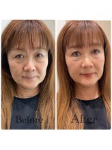 シャルム(Sharme)/お客様Before→After