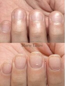 マリーロール 梅田店(Marie Laure)/自爪育成/深爪矯正/ネイルケア