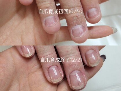 ミンスネイル(Mins Nail)の写真