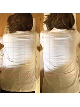 カイロプラクティック ネクサス/背中のねじれと肩こり撃退☆