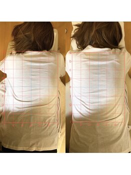 カイロプラクティック ネクサス/背中のねじれと肩こり撃退☆
