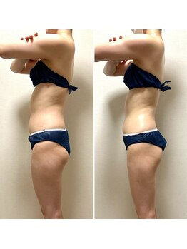 ラ マジ(La Magie)/