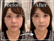 R-1ビューティーサロン 銀座/Before＆After
