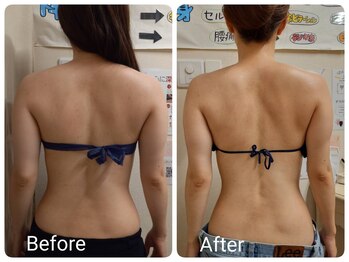 スマイルボディ つぼの森 吉野店(Smile body)/ブライダルエステ