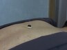 【副院長施術】新規限定 全身鍼灸施術　￥8800