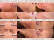 ビジュープラス ひたち野うしく店(Bijou+)