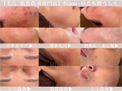 ビジュープラス ひたち野うしく店(Bijou+)の写真