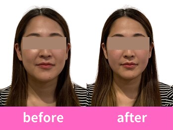 あぐり鍼灸整骨院/