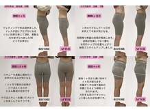 ビジリンヌ/パーソナル　広島市