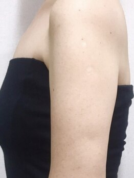 アエ メゾン(ae maison)の写真/頑固なニの腕もスッキリ引き締めて自分史上最高にキレイな姿に◎気になるお肉はae maisonにお任せ★