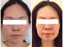 美容整体 ウェリナ 蟹江院/小顔矯正/骨盤矯正/美脚サロン 