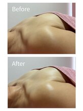 チュラ 大宮店(Chura)/【50代】初回バストアップ/大宮