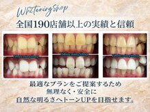 ホワイトニングショップ 三田店の雰囲気（歯科提携ジェル使用/三田市内No. 1の照射時間でしっかり白く）