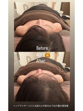 ドゥース 自由が丘(Douce)/施術ビフォーアフター