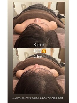 ドゥース 自由が丘(Douce)/施術ビフォーアフター