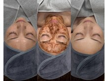 イーヴ(Eave)/【肌質改善】カカオピーリング