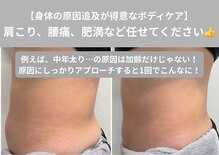 ヴィセラ(Vicella)