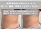 ヴィセラ(Vicella)の写真