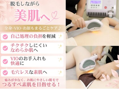 ニコル 名東店(NICOL)の写真
