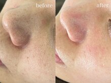 テオリア(TEORIA)/平日限定割引メニューあります♪