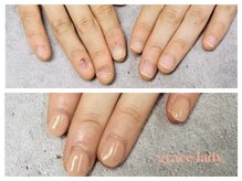 グレースレディ 神戸北店/