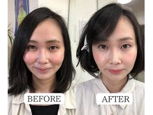 ベルヴェール(Bellevert)/感動のビフォーアフター