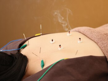 鍼灸サロン アヤカ(AYAKA)/鍼灸施術