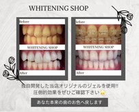 ホワイトニングショップ 安城店
